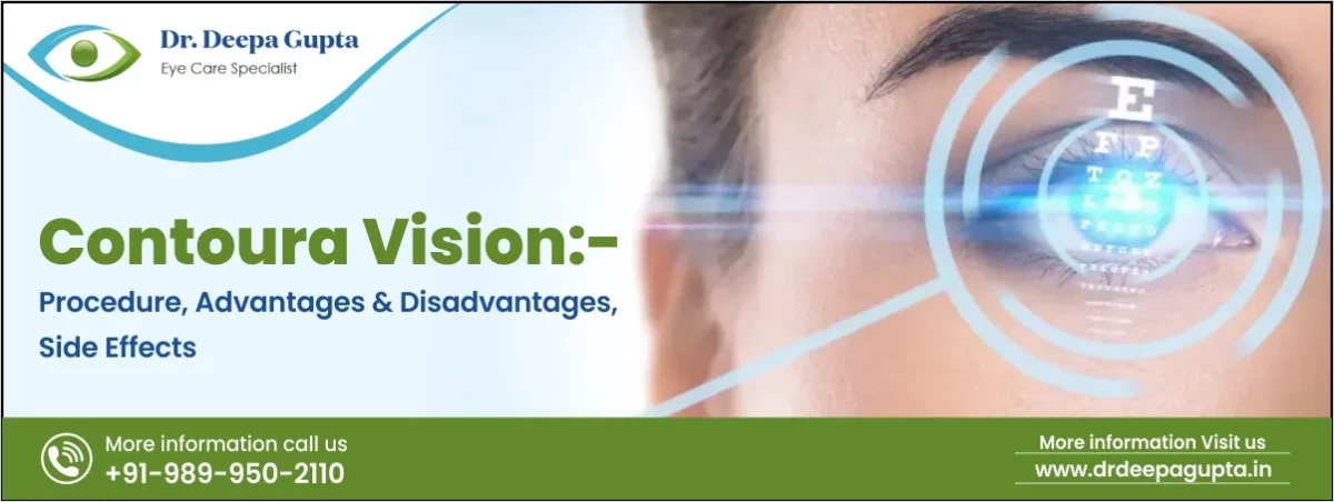 Contoura Vision:- What is Contoura Vision Surgery?